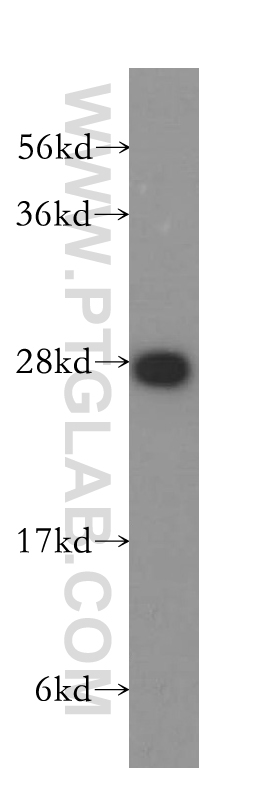 WB analysis of HeLa using 10754-2-AP