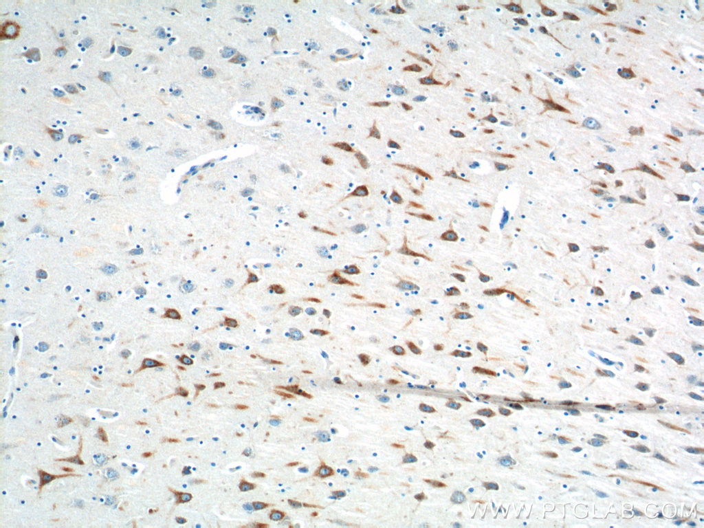 IHC staining of human brain using 14357-1-AP