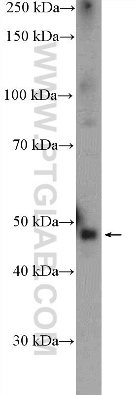 WB analysis of mouse brain using 24761-1-AP