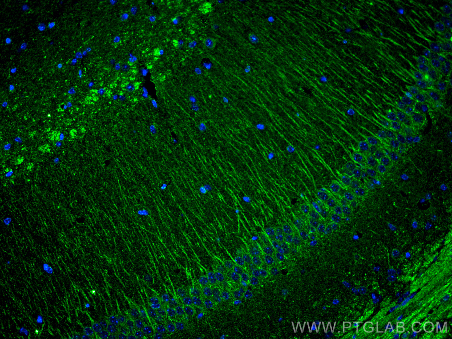 IF Staining of mouse brain using 66921-1-Ig (same clone as 66921-1-PBS)