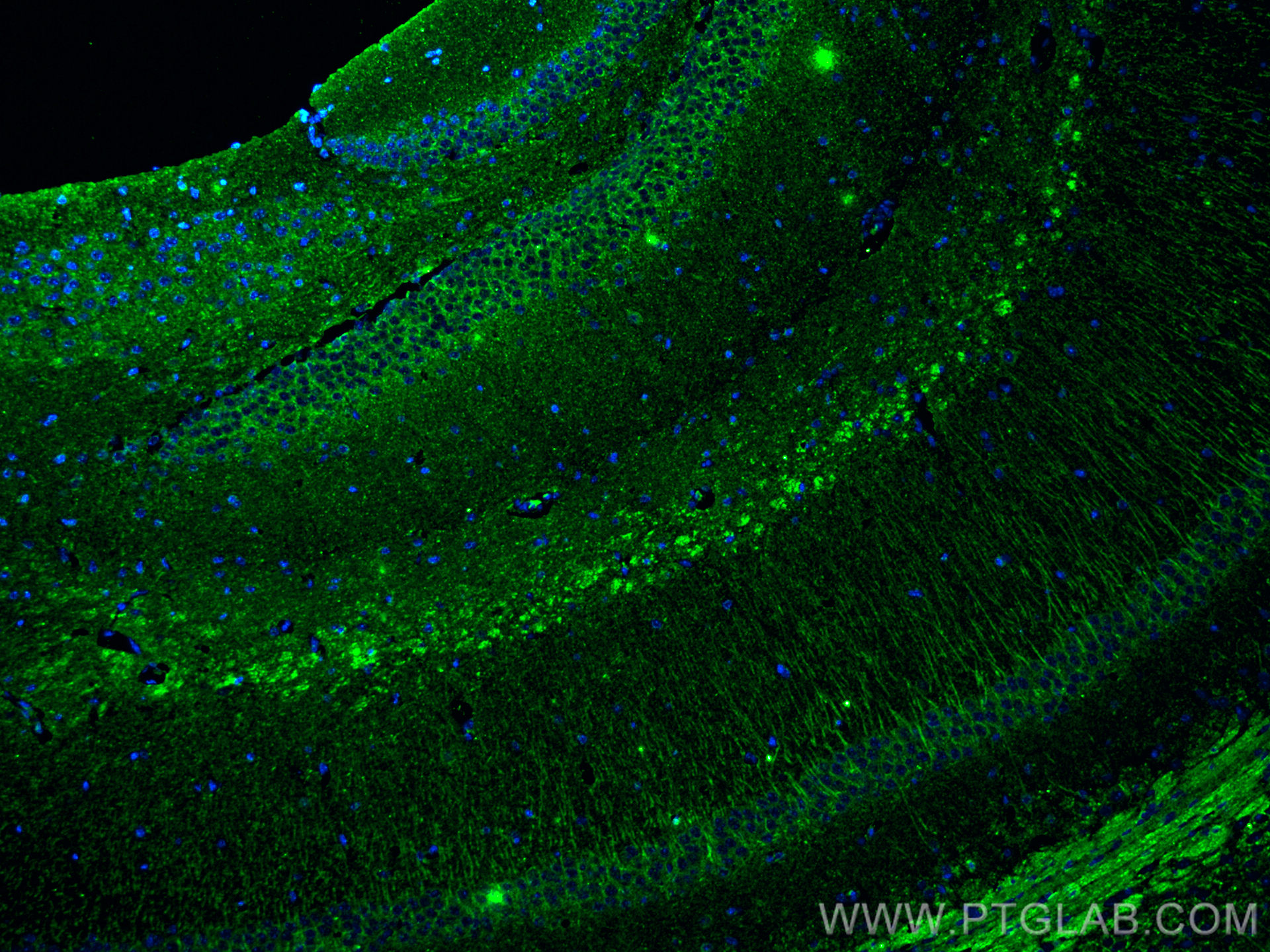 IF Staining of mouse brain using 66921-1-Ig