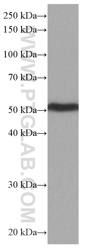 WB analysis of pig brain using 66921-1-Ig (same clone as 66921-1-PBS)