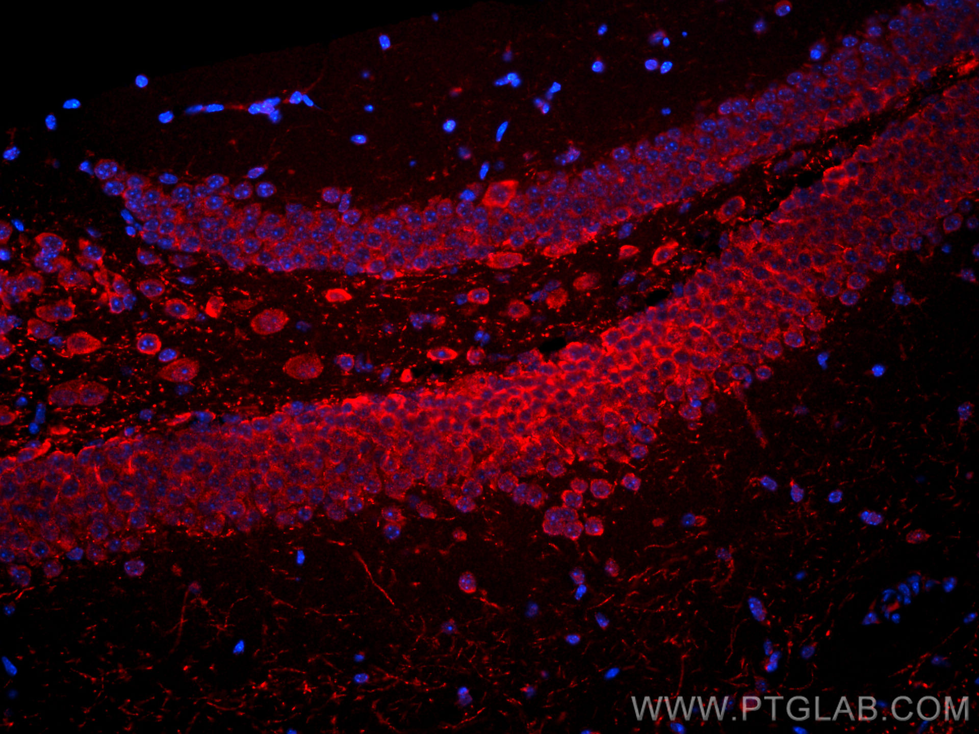 IF Staining of mouse brain using CL594-66921