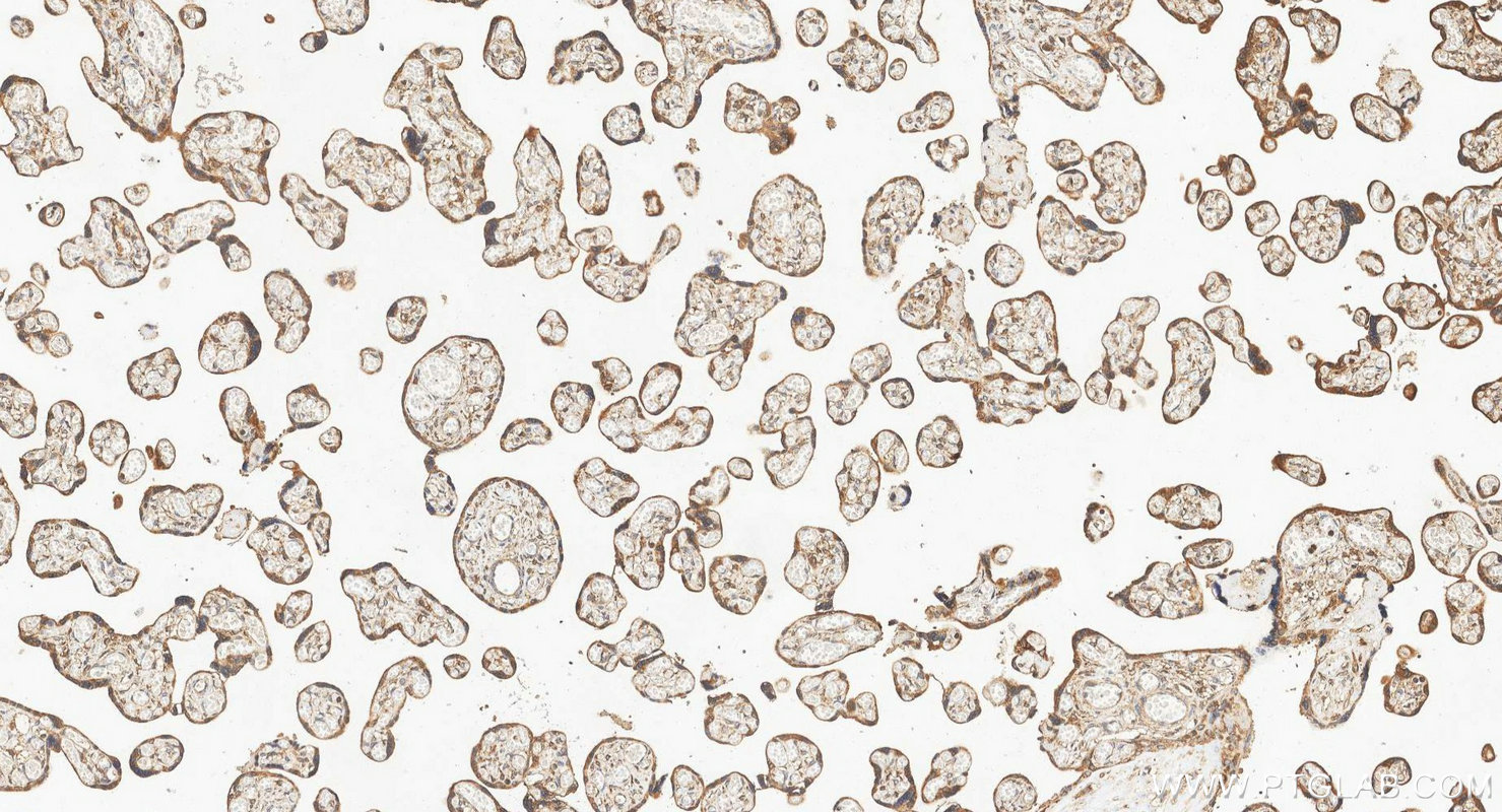 IHC staining of human placenta using 10596-1-AP IHC staining of human placenta using 10596-1-AP