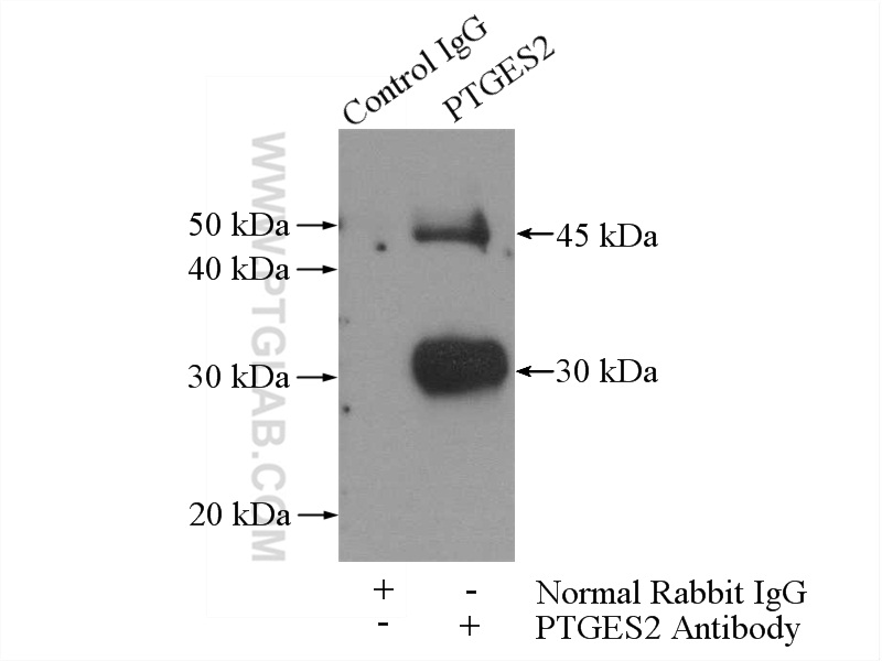 IP experiment of mouse heart using 10881-1-AP