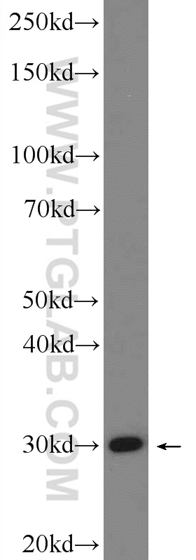 WB analysis of HeLa using 10881-1-AP