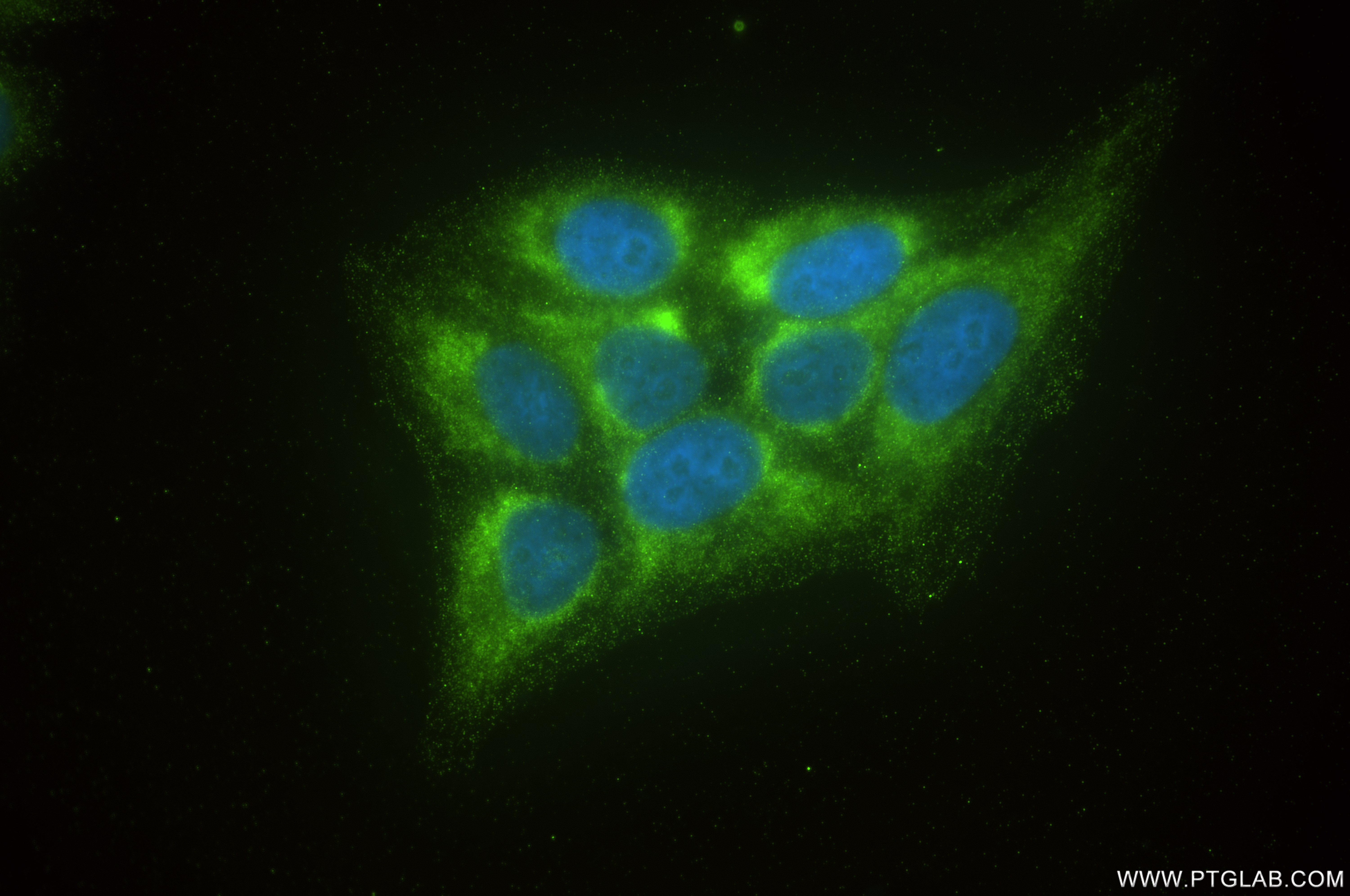 IF Staining of HepG2 using 85419-4-RR (same clone as 85419-4-PBS)