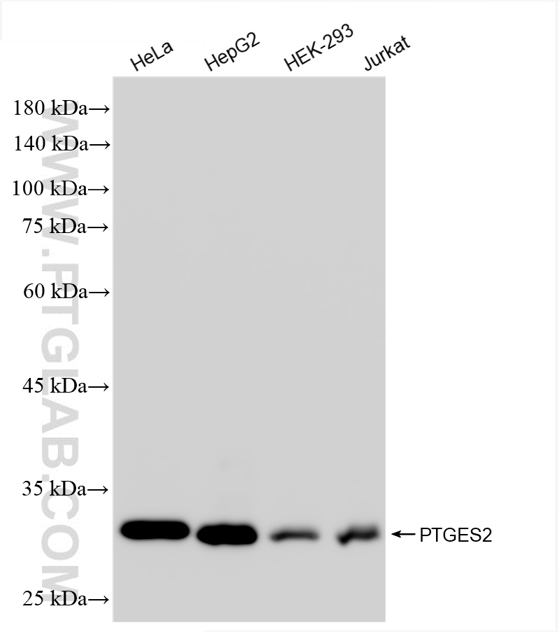 WB analysis using 85419-4-RR (same clone as 85419-4-PBS)
