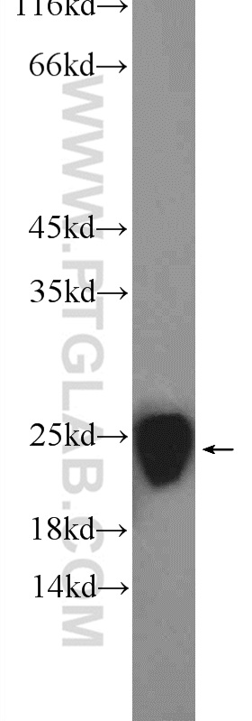 WB analysis of rat brain using 15216-1-AP