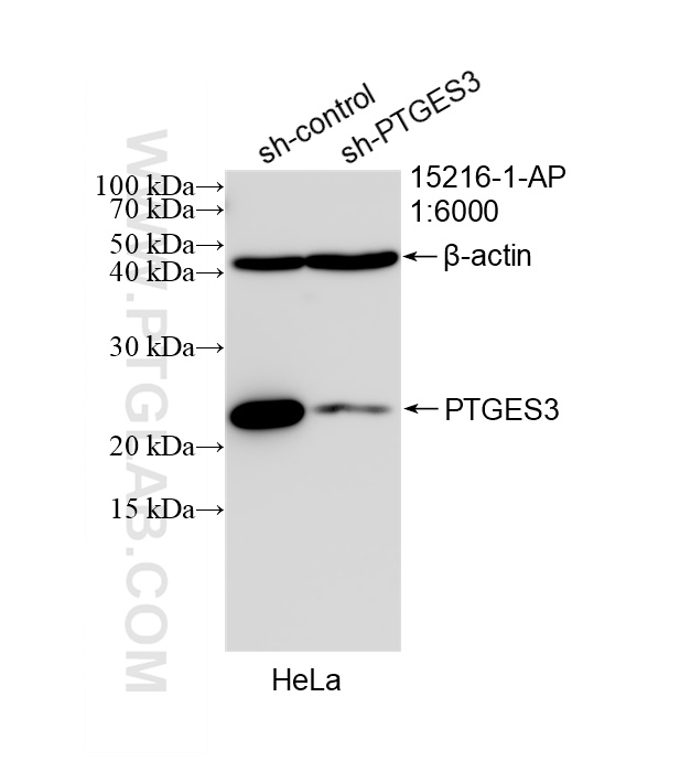 WB analysis of HeLa using 15216-1-AP