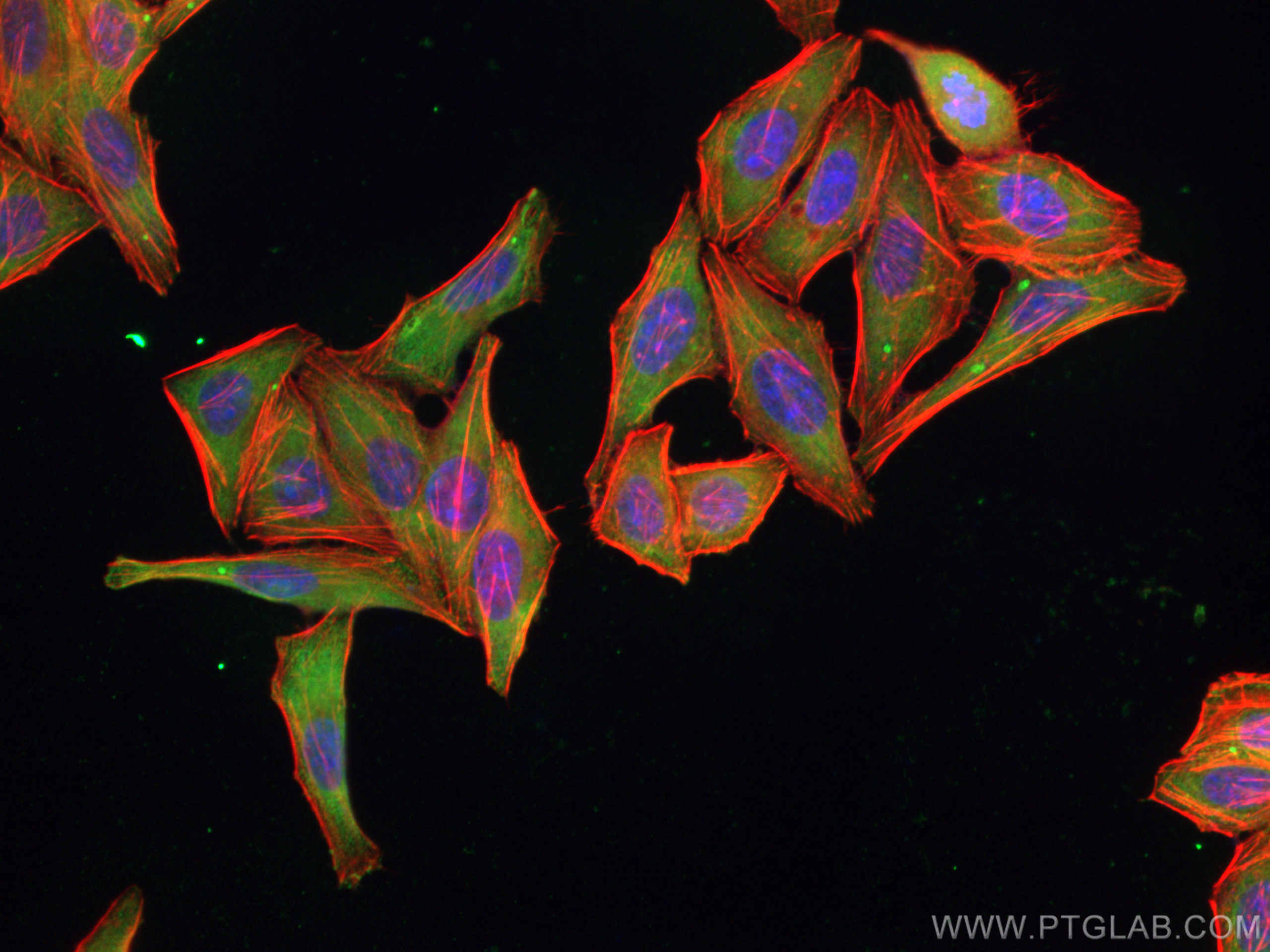 IF Staining of HepG2 using 67736-1-Ig (same clone as 67736-1-PBS)
