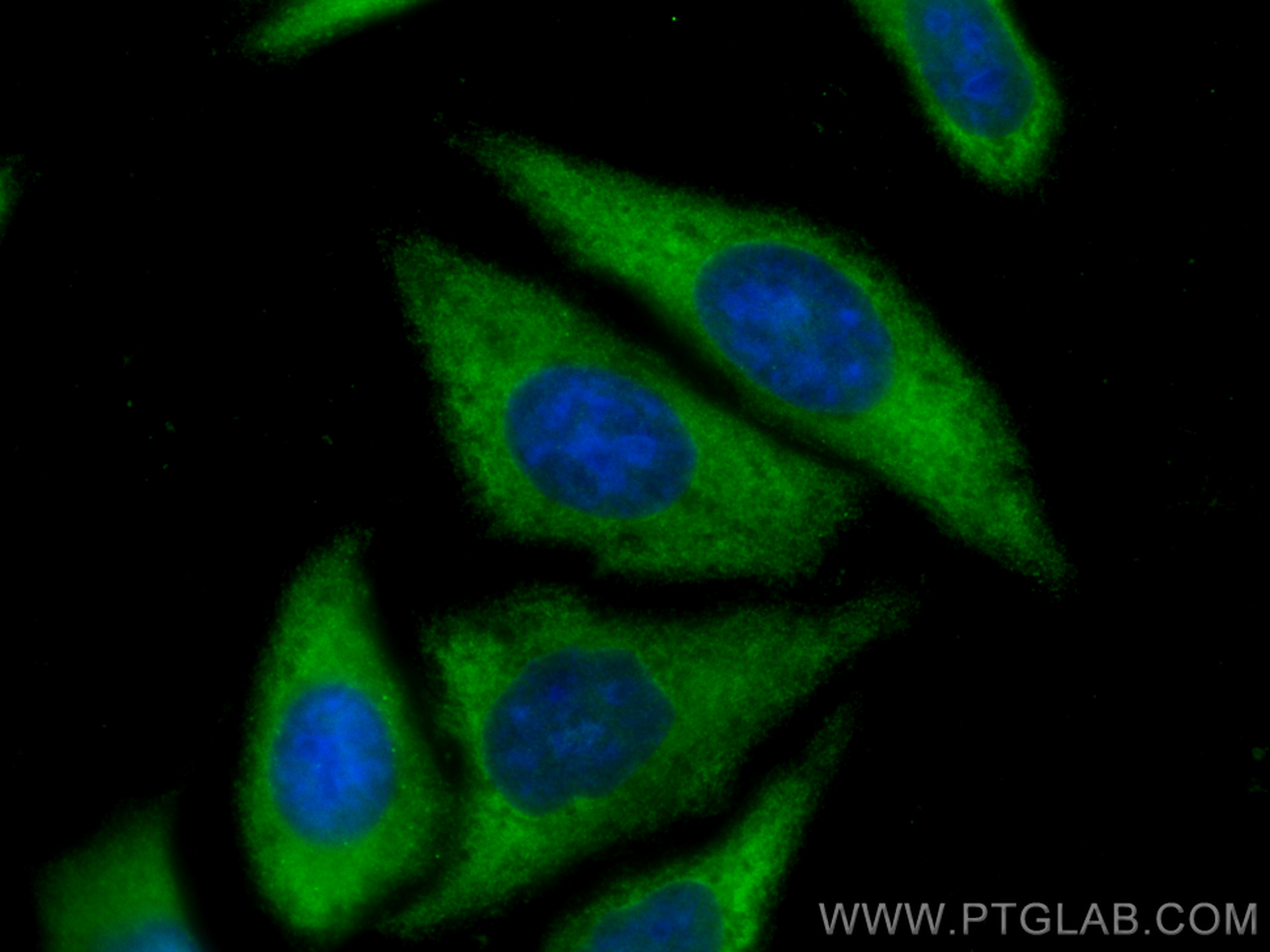 IF Staining of HepG2 using 67736-1-Ig