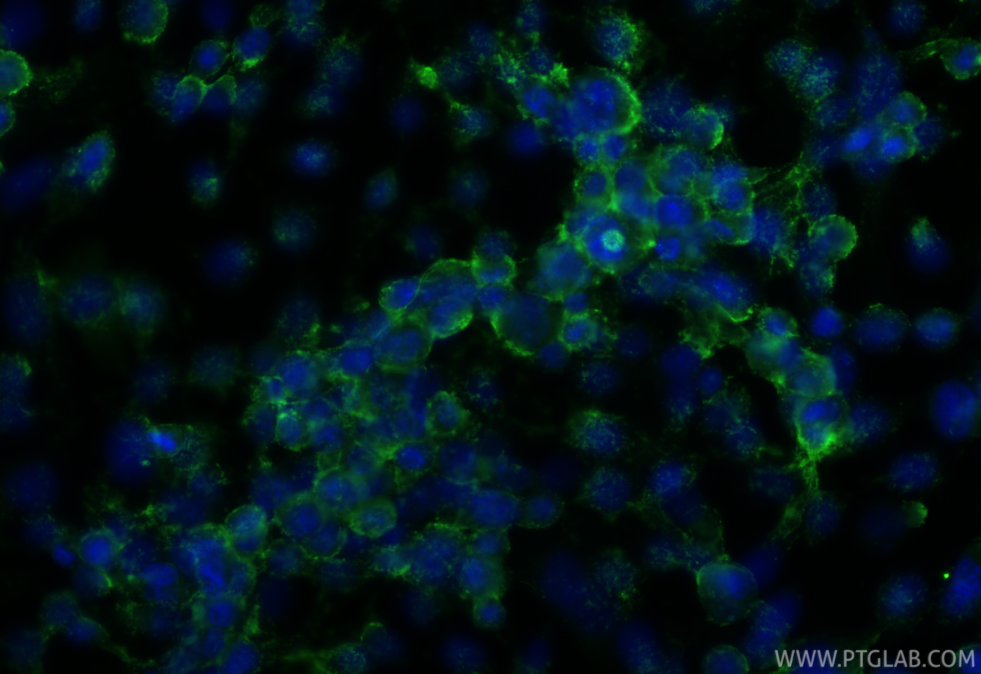 IF Staining of PC-3 using 21595-1-AP (same clone as 21595-1-PBS) IF Staining of PC-3 using 21595-1-AP (same clone as 21595-1-PBS)