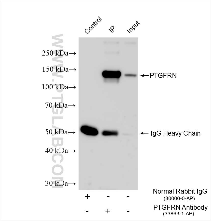 IP experiment of HeLa using 33863-1-AP