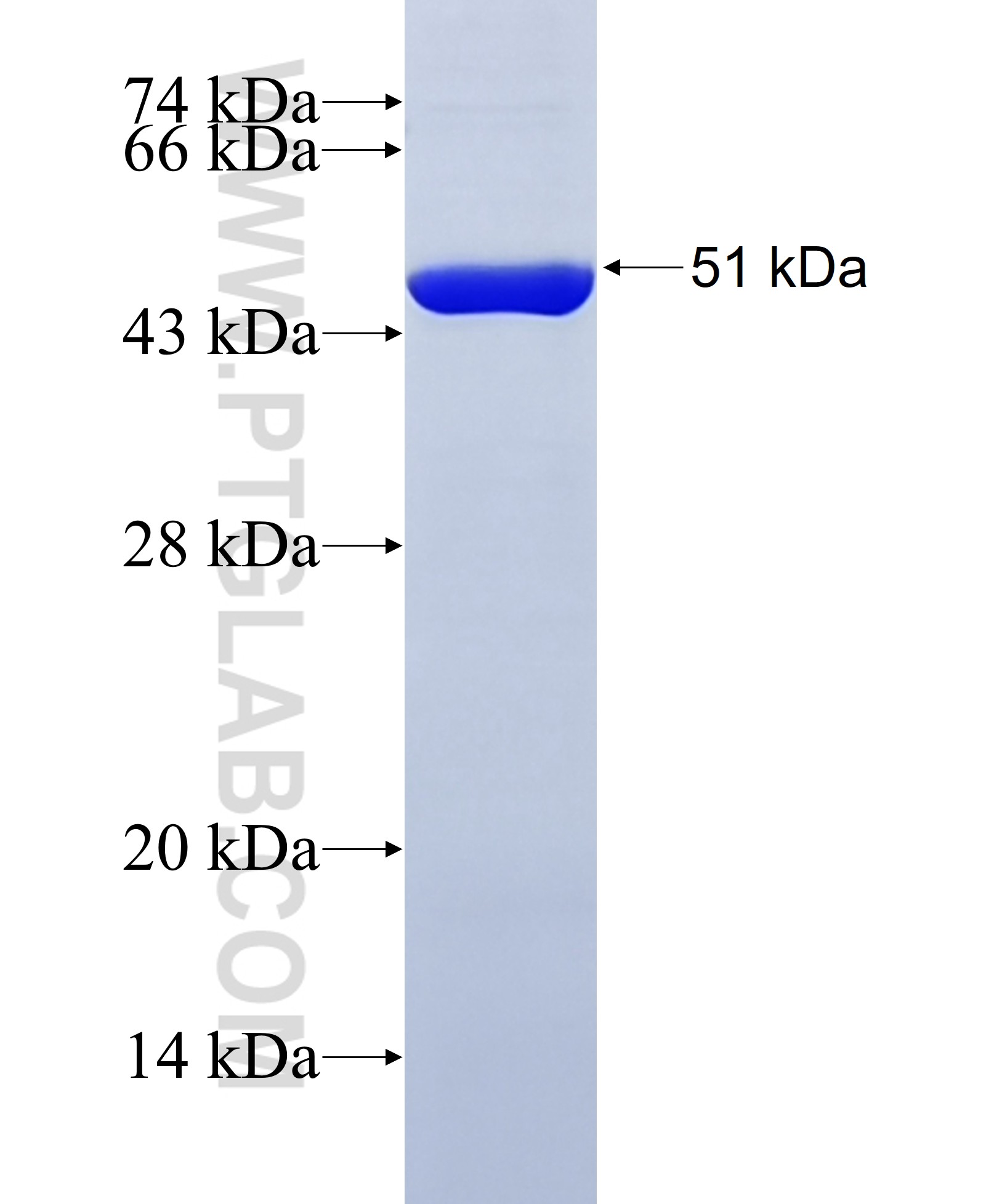 PTGFRN fusion protein Ag20203 SDS-PAGE PTGFRN fusion protein Ag20203 SDS-PAGE