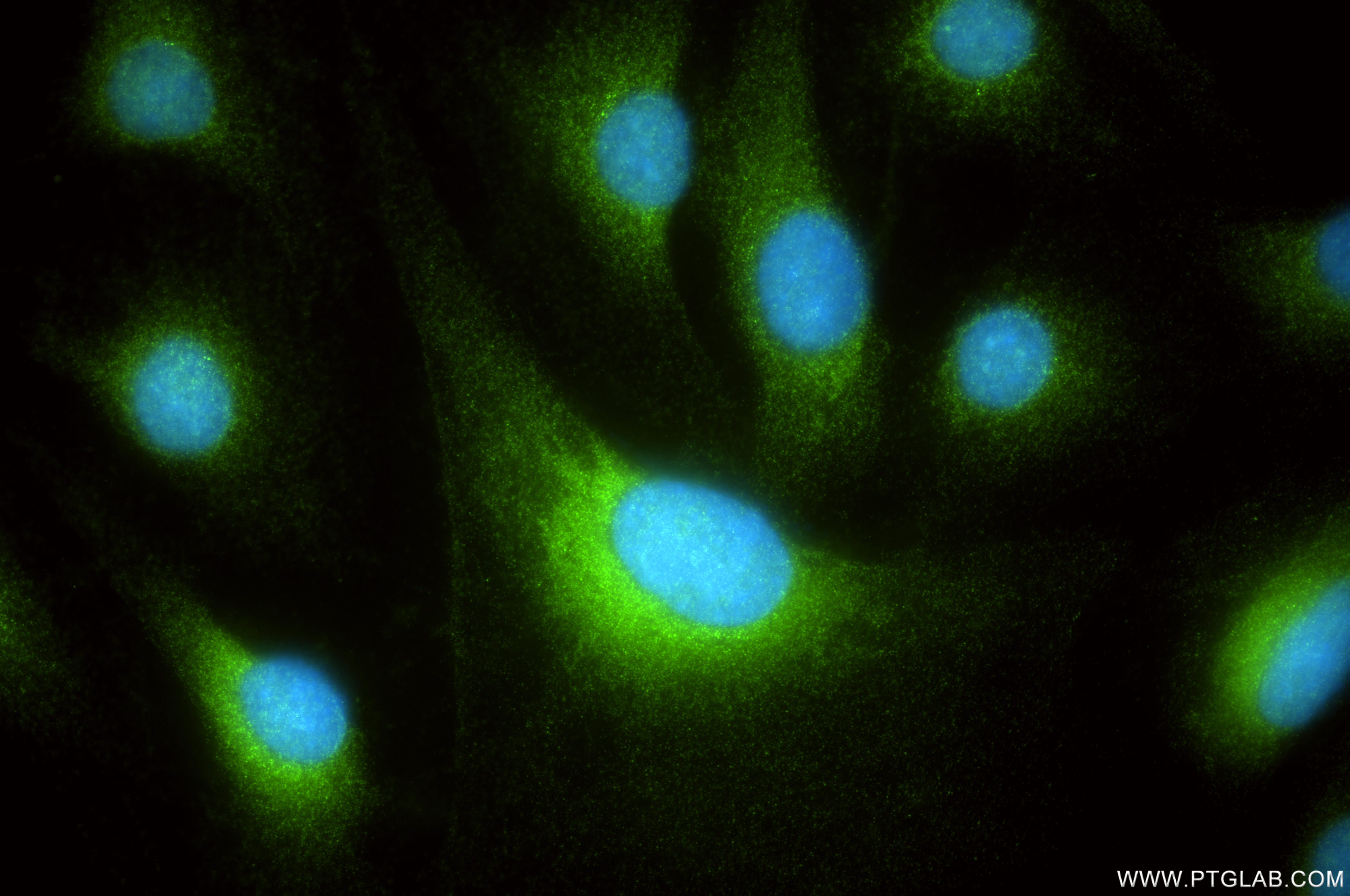 IF Staining of U2OS using 85810-1-RR
