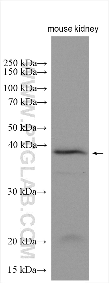 WB analysis of mouse kidney using 14164-1-AP