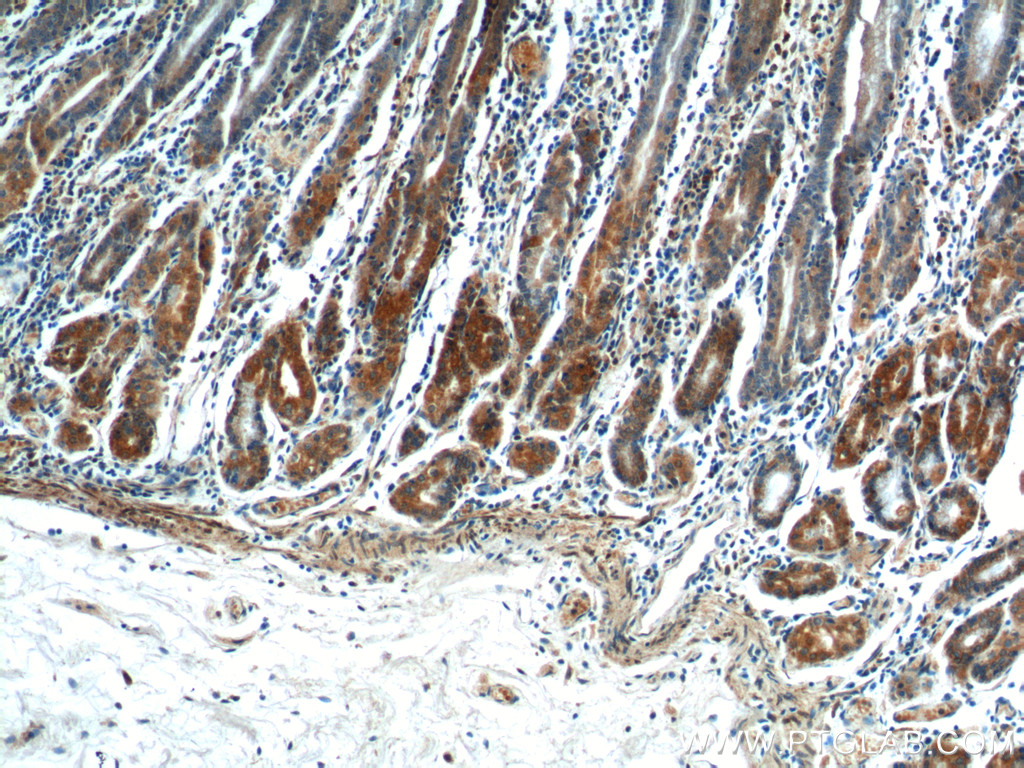 IHC staining of human stomach using 13393-1-AP