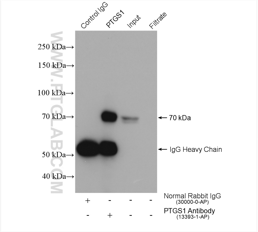 IP experiment of HeLa using 13393-1-AP