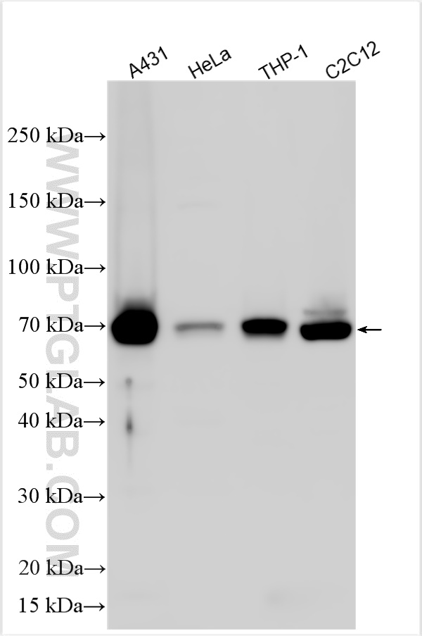WB analysis using 13393-1-AP