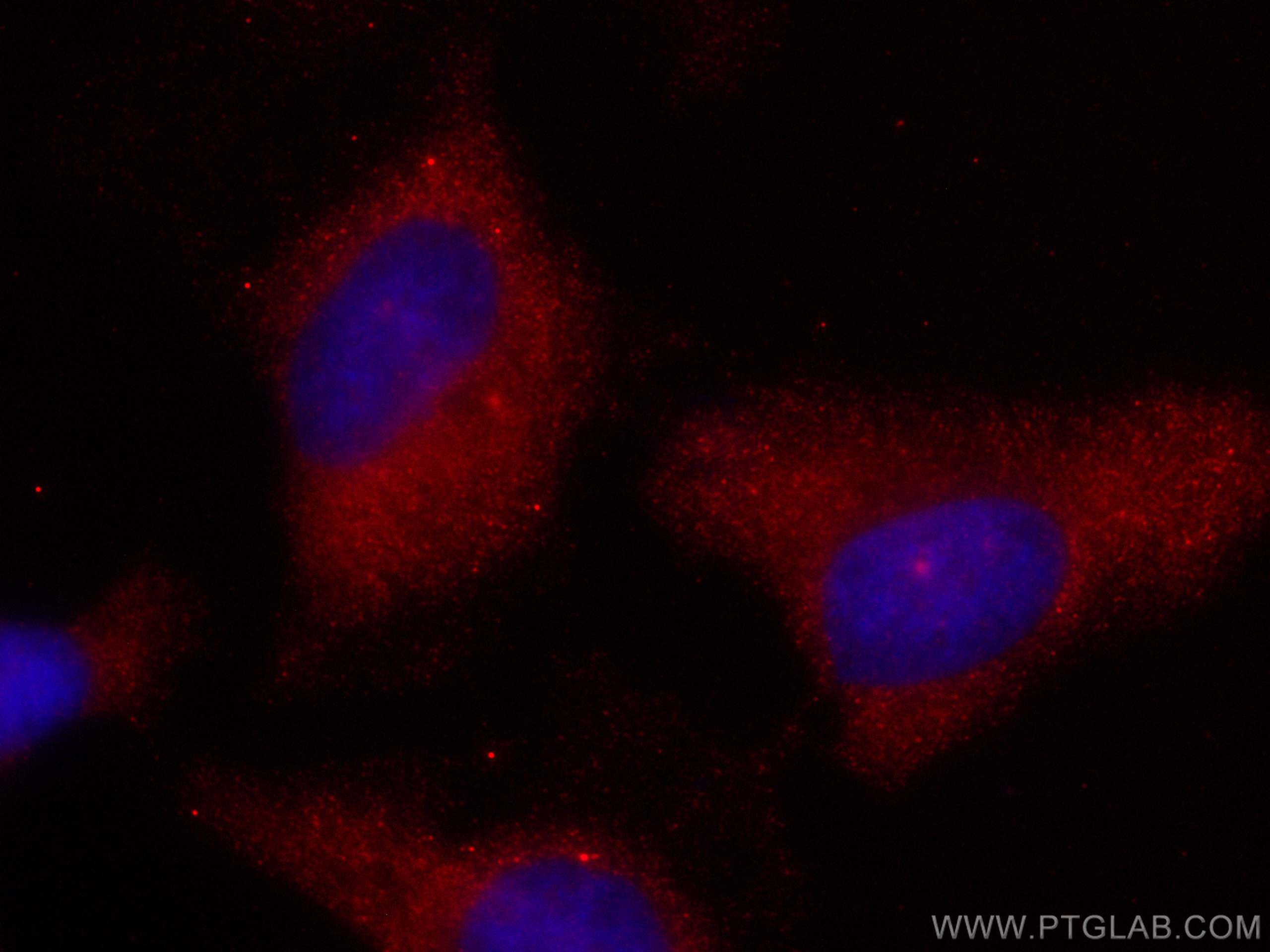 COX-1/Cyclooxygenase-1