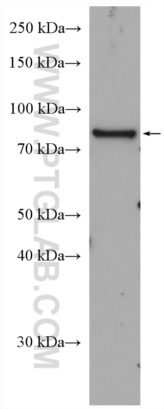 WB analysis of U2OS using 24275-1-AP