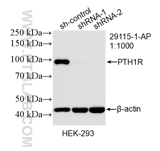 WB analysis of HEK-293 using 29115-1-AP