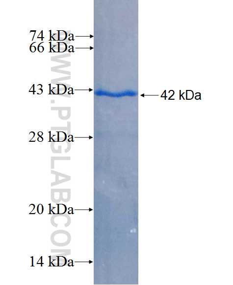 PTHLH fusion protein Ag26725 SDS-PAGE PTHLH fusion protein Ag26725 SDS-PAGE