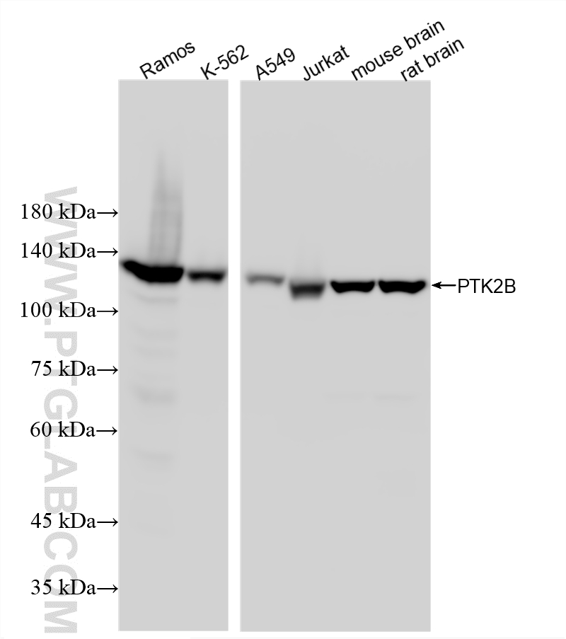 WB analysis using 87746-1-RR WB analysis using 87746-1-RR