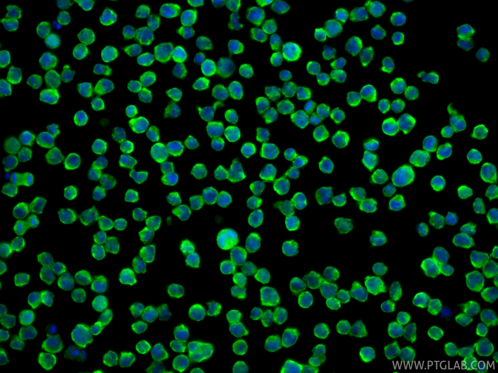 IF Staining of Jurkat using 17592-1-AP