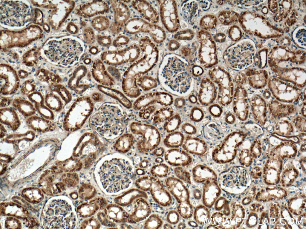 IHC staining of human kidney using 17592-1-AP