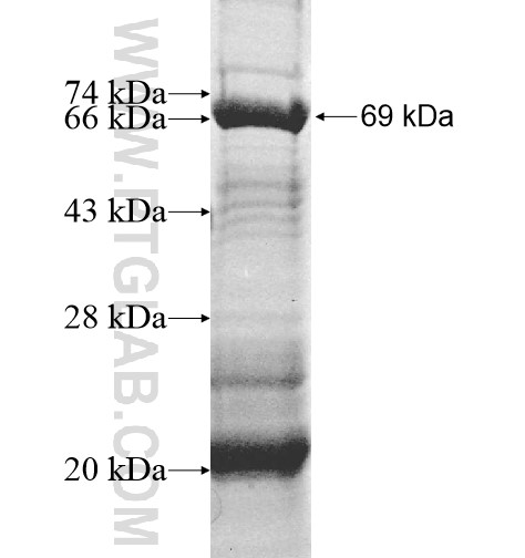 PTK2B fusion protein Ag11500 SDS-PAGE PTK2B fusion protein Ag11500 SDS-PAGE