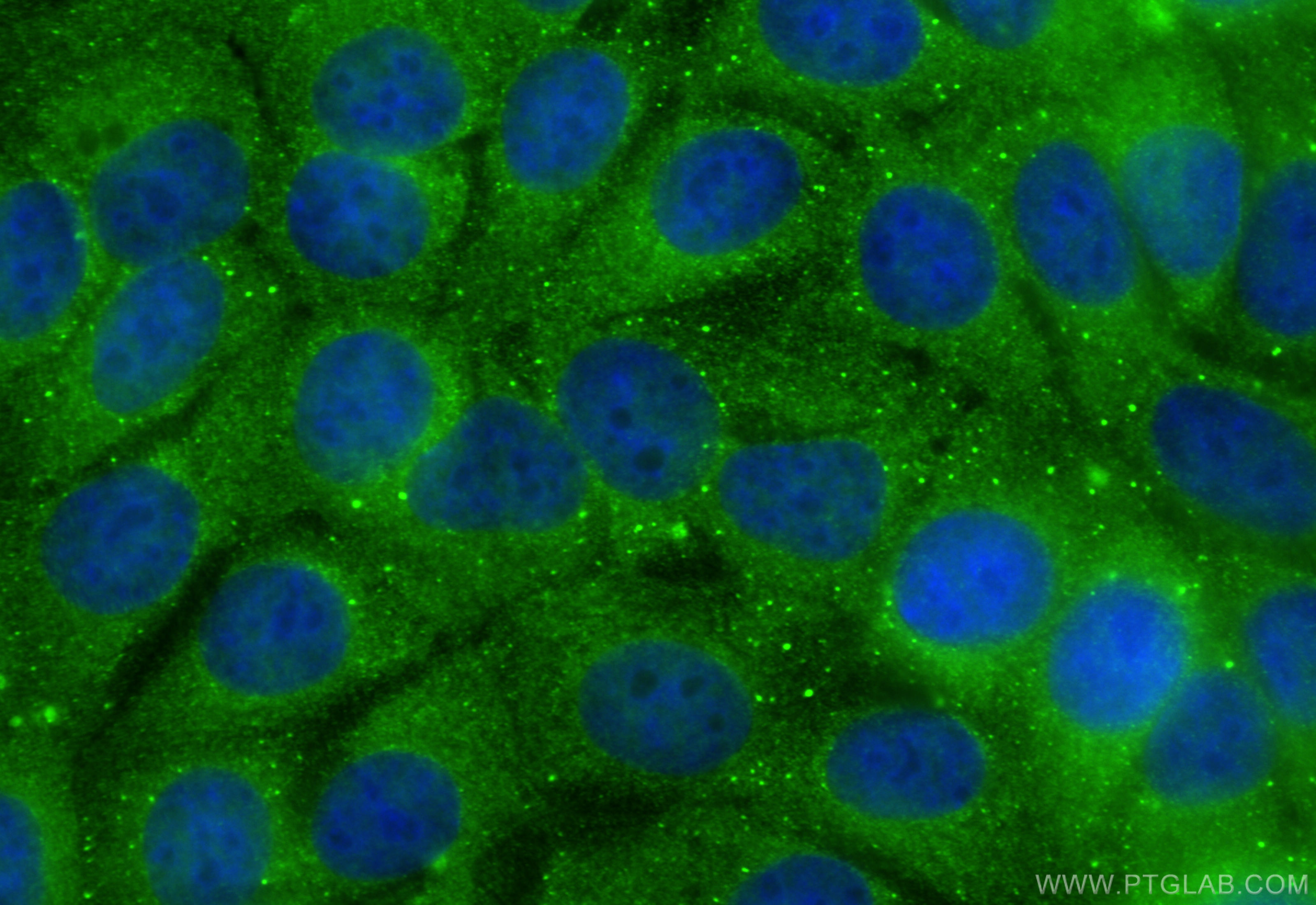 IF Staining of MCF-7 using 18697-1-AP