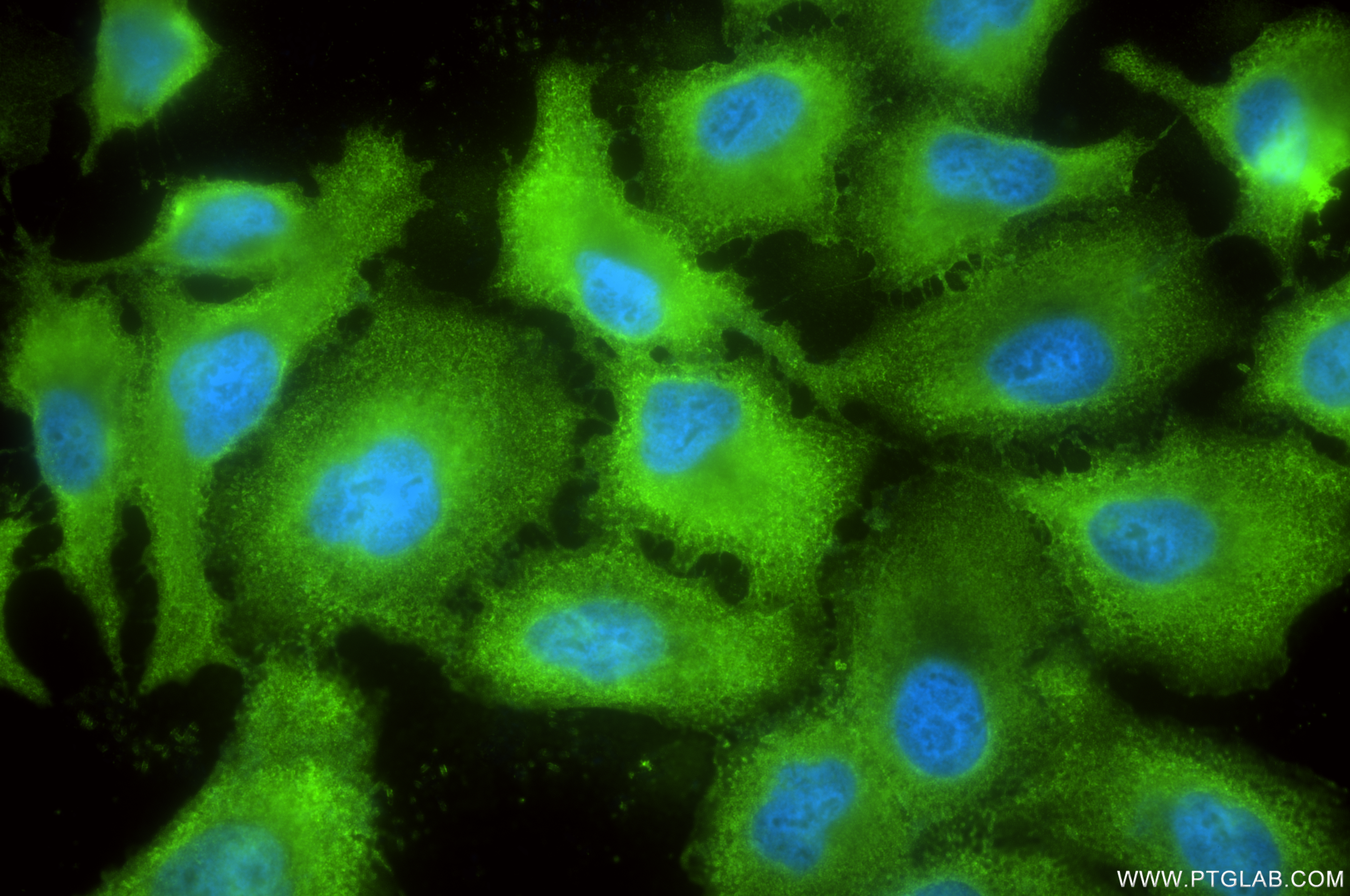IF Staining of A549 using 85352-2-RR