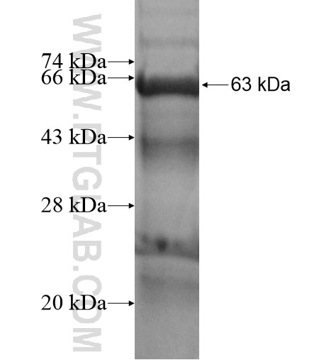 PTK6 fusion protein Ag15561 SDS-PAGE PTK6 fusion protein Ag15561 SDS-PAGE