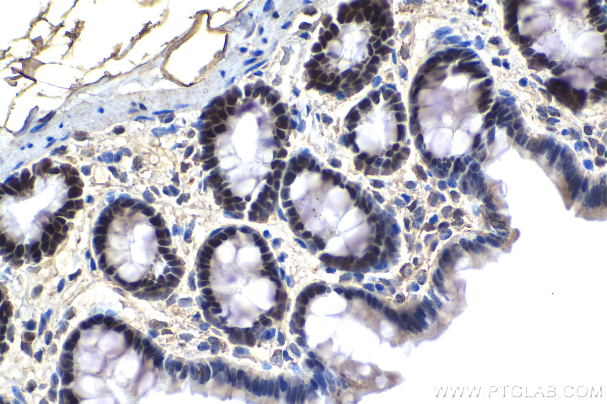 IHC staining of rat colon using 10480-1-AP