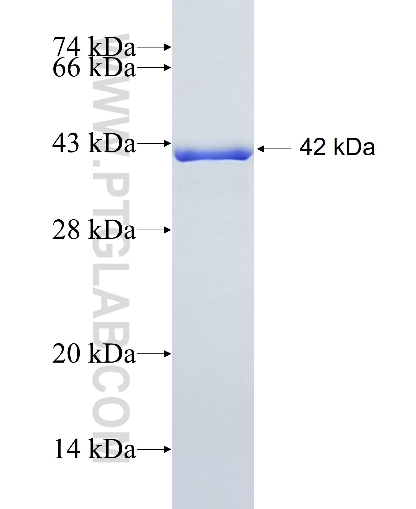 PTMS fusion protein Ag2751 SDS-PAGE