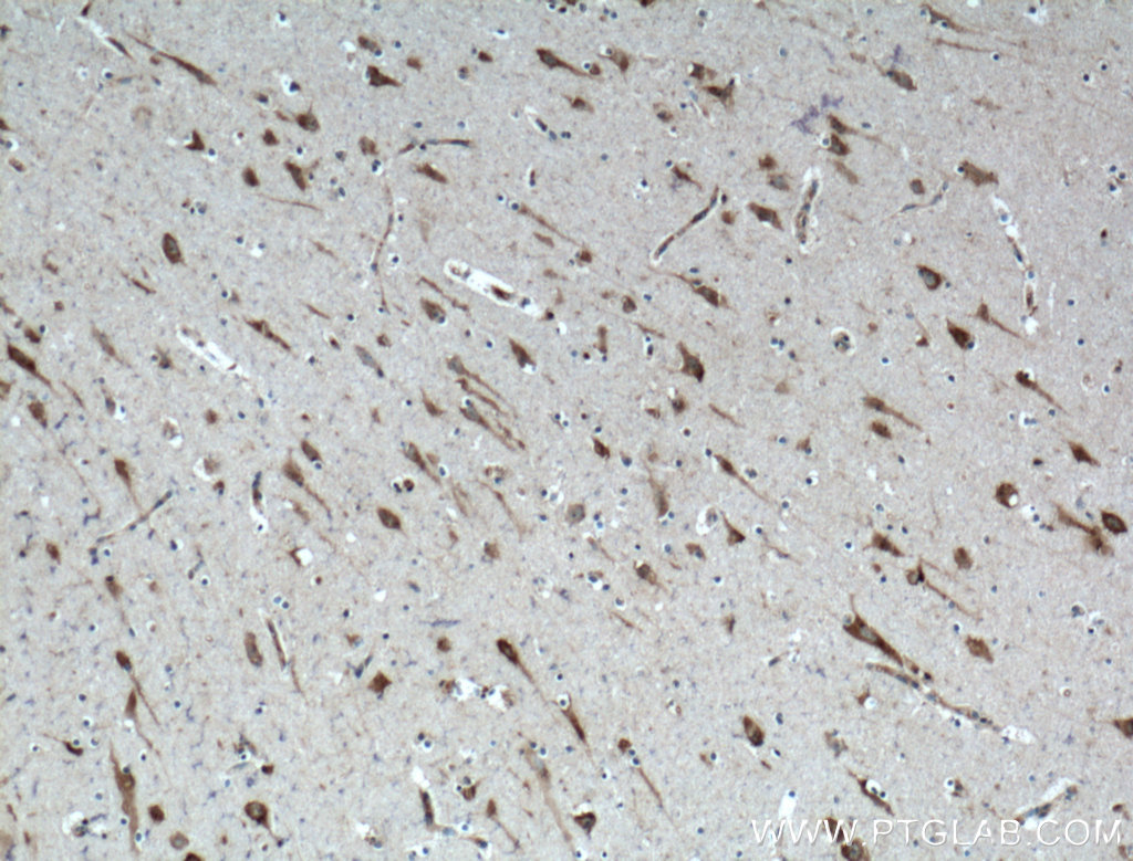 IHC staining of human brain using 27117-1-AP