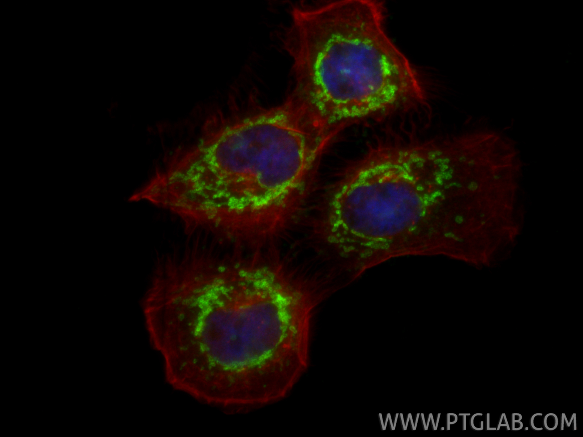 IF Staining of A431 using 20641-1-AP IF Staining of A431 using 20641-1-AP