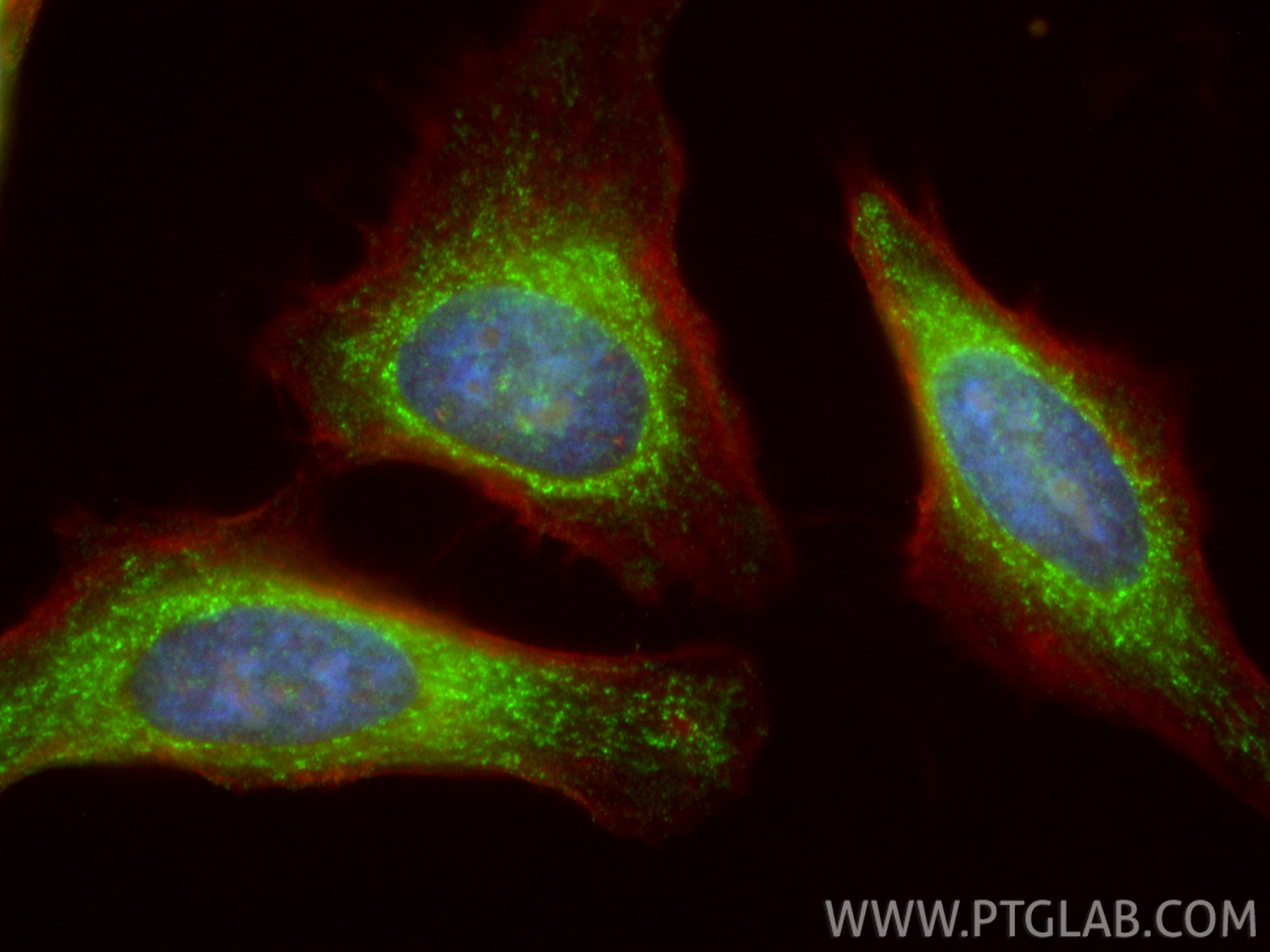 IF Staining of HeLa using 20641-1-AP IF Staining of HeLa using 20641-1-AP