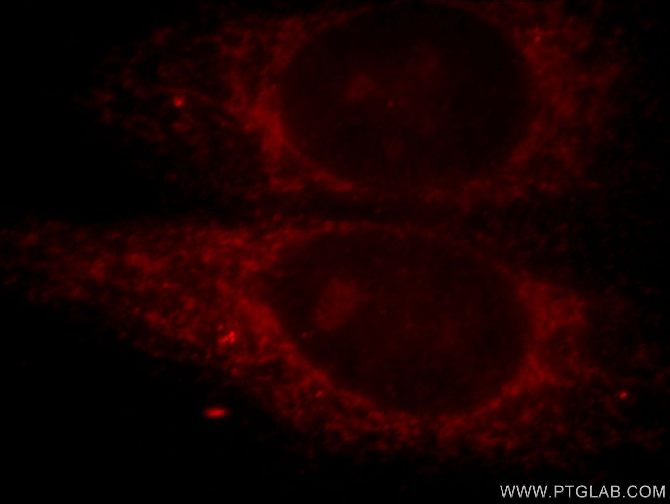 IF Staining of HepG2 using 20641-1-AP