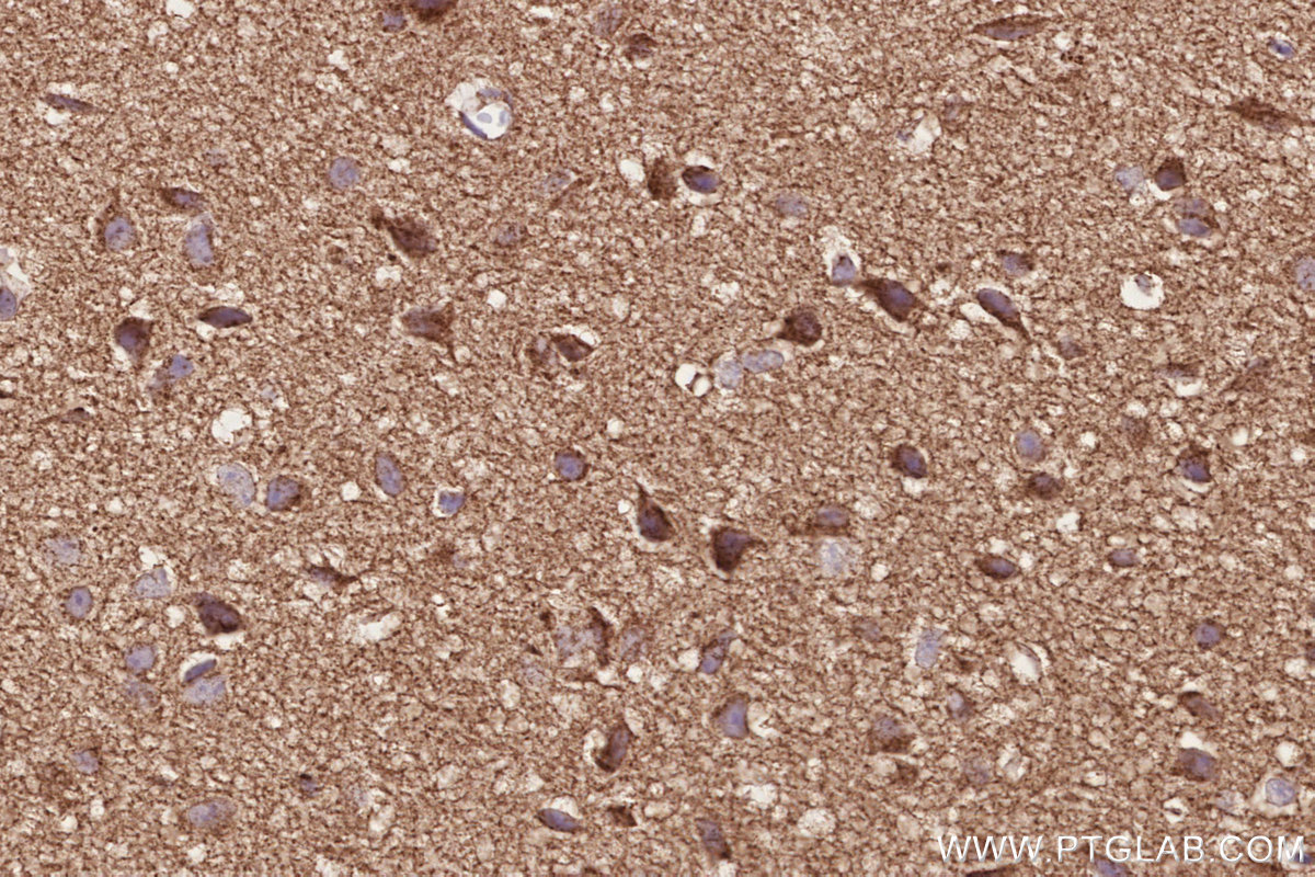 IHC staining of mouse brain using 20641-1-AP