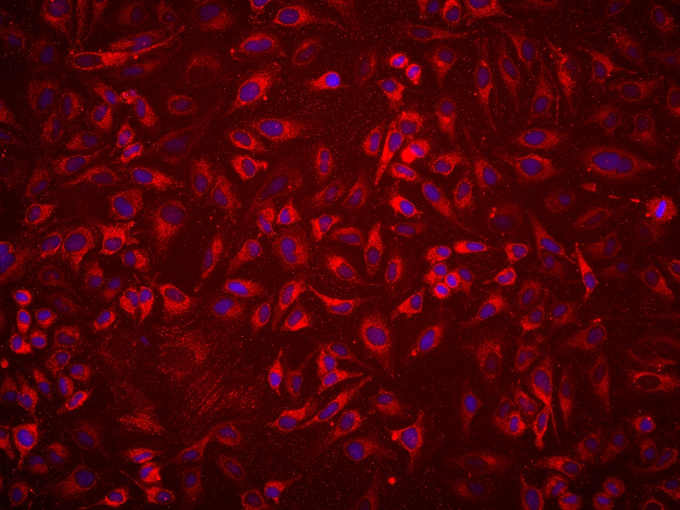 IF Staining of HeLa using 68582-1-Ig