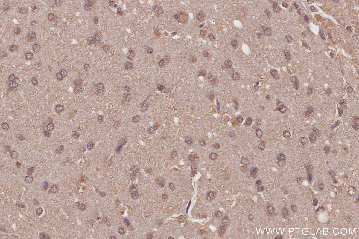 IHC staining of rat brain using 68582-1-Ig