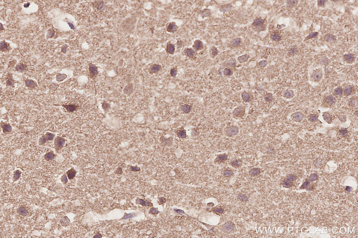 IHC staining of mouse brain using 68582-1-Ig