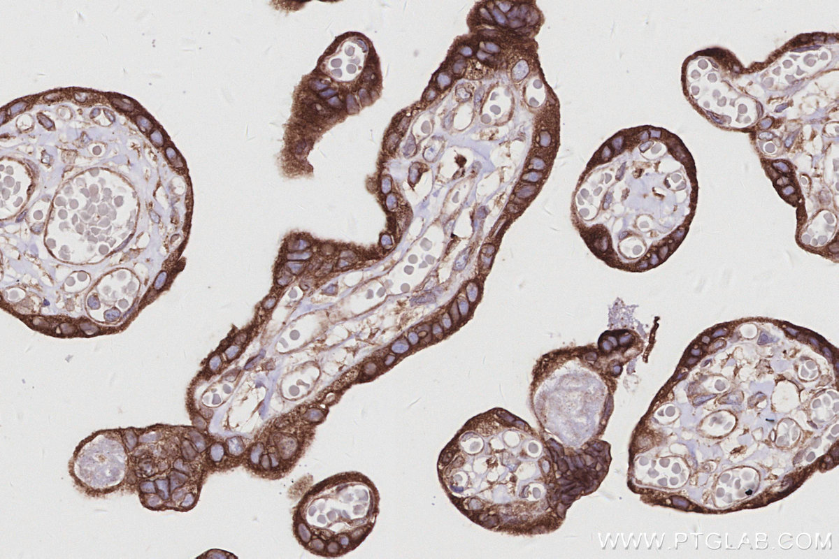 IHC staining of human placenta using 28572-1-AP