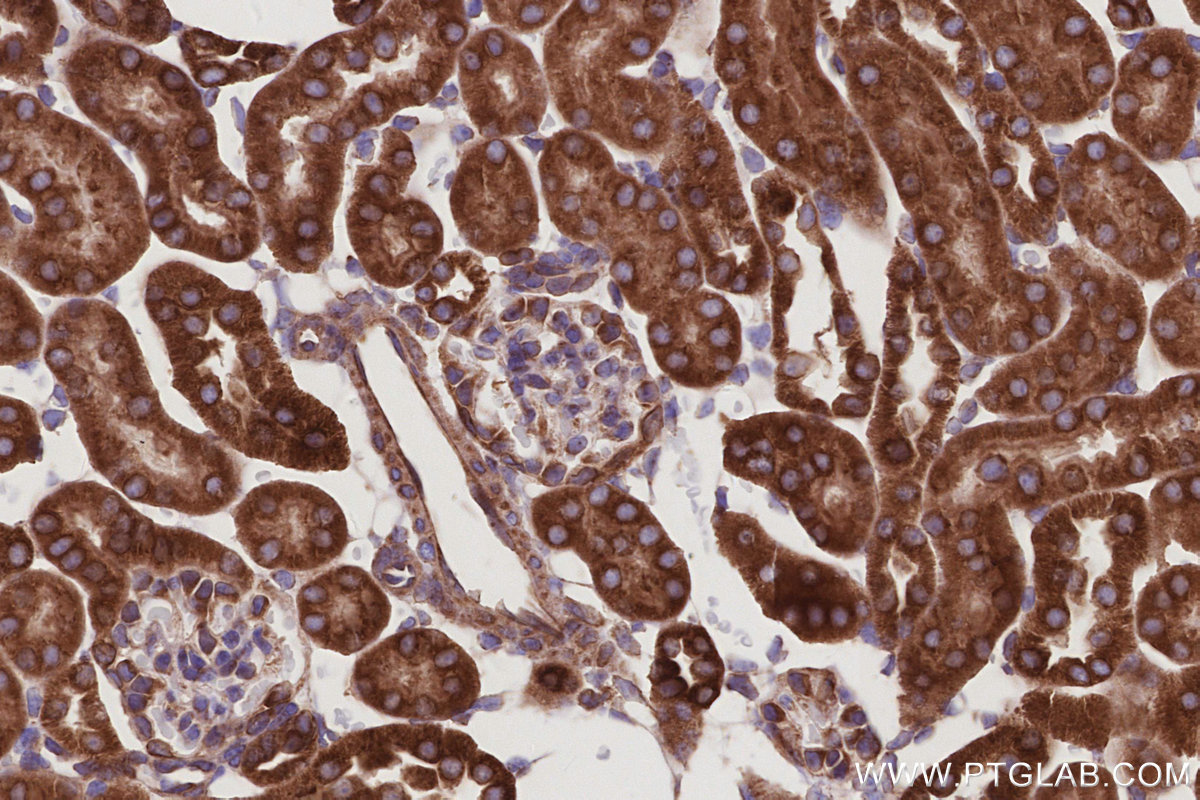 IHC staining of mouse kidney using 28572-1-AP