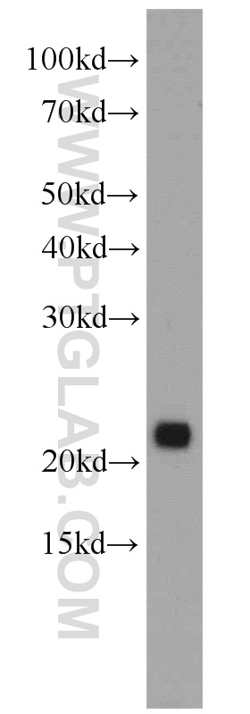 WB analysis of mouse pancreas using 11493-1-AP