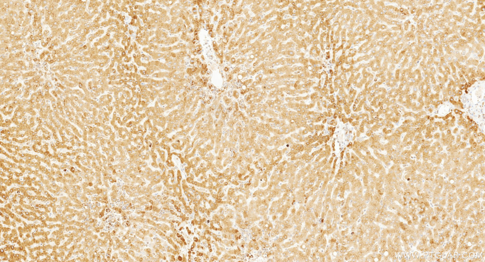 IHC staining of human liver using 87082-1-RR IHC staining of human liver using 87082-1-RR
