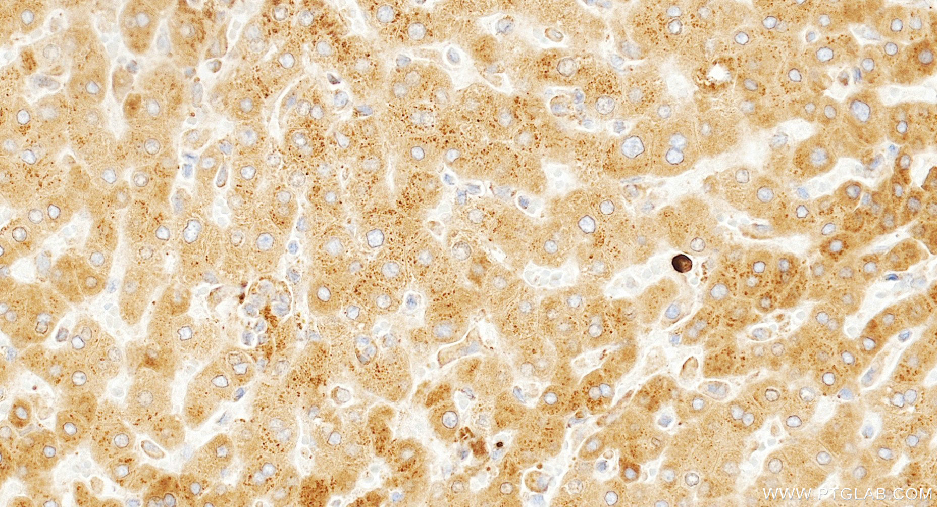 IHC staining of human liver using 87082-1-RR IHC staining of human liver using 87082-1-RR